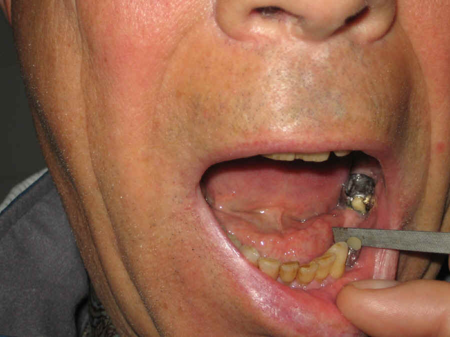 my dental work_1.jpg (146697 bytes)